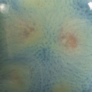 Risultati estetici dello smalto in cottura