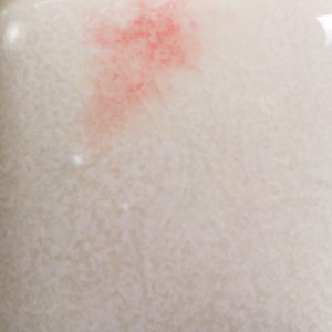 Risultati estetici dello smalto in cottura