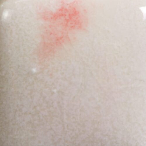 Risultati estetici dello smalto in cottura