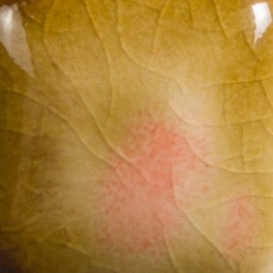 Risultati estetici dello smalto in cottura