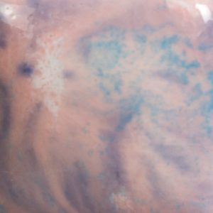 Risultati estetici dello smalto in cottura