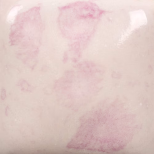 Risultati estetici dello smalto in cottura